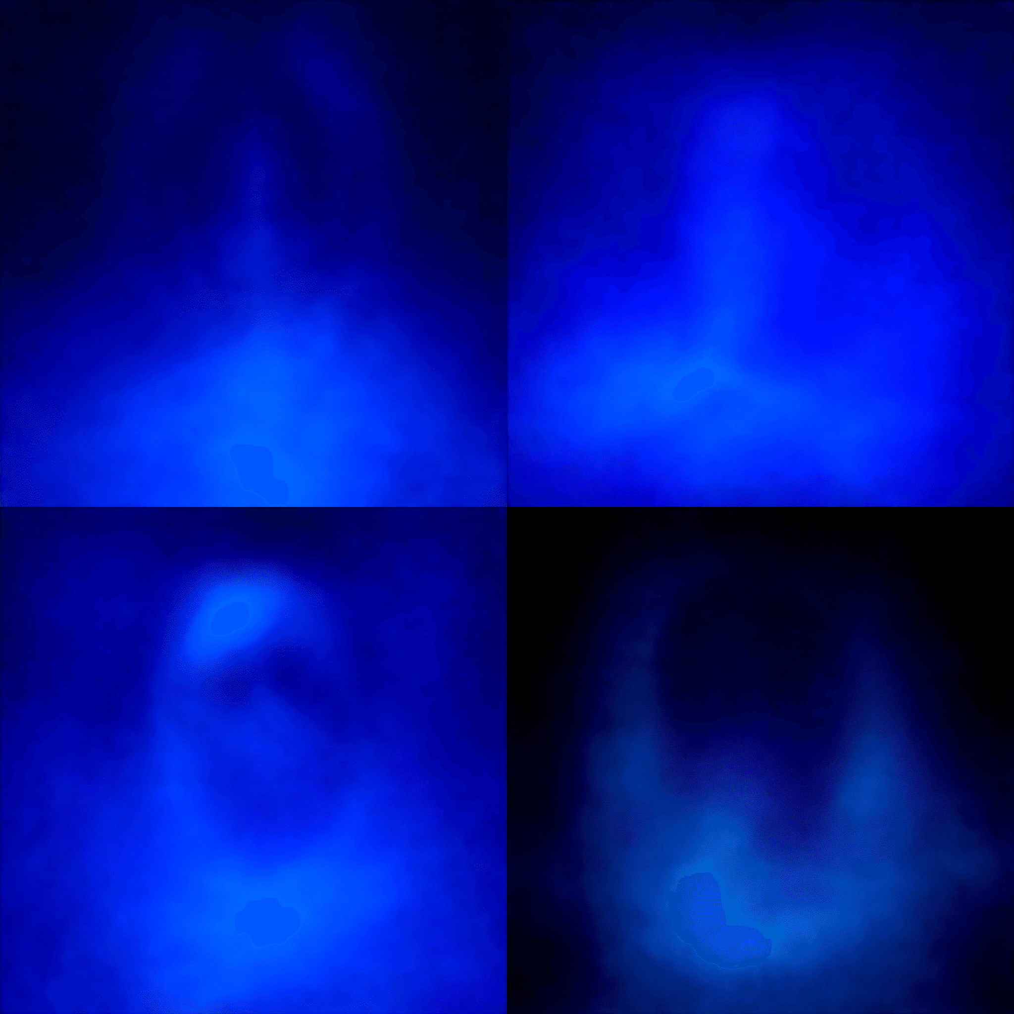 Advanced Views WordPress Plugin CVE-2025-10380: Brief Summary of Server-Side Template Injection