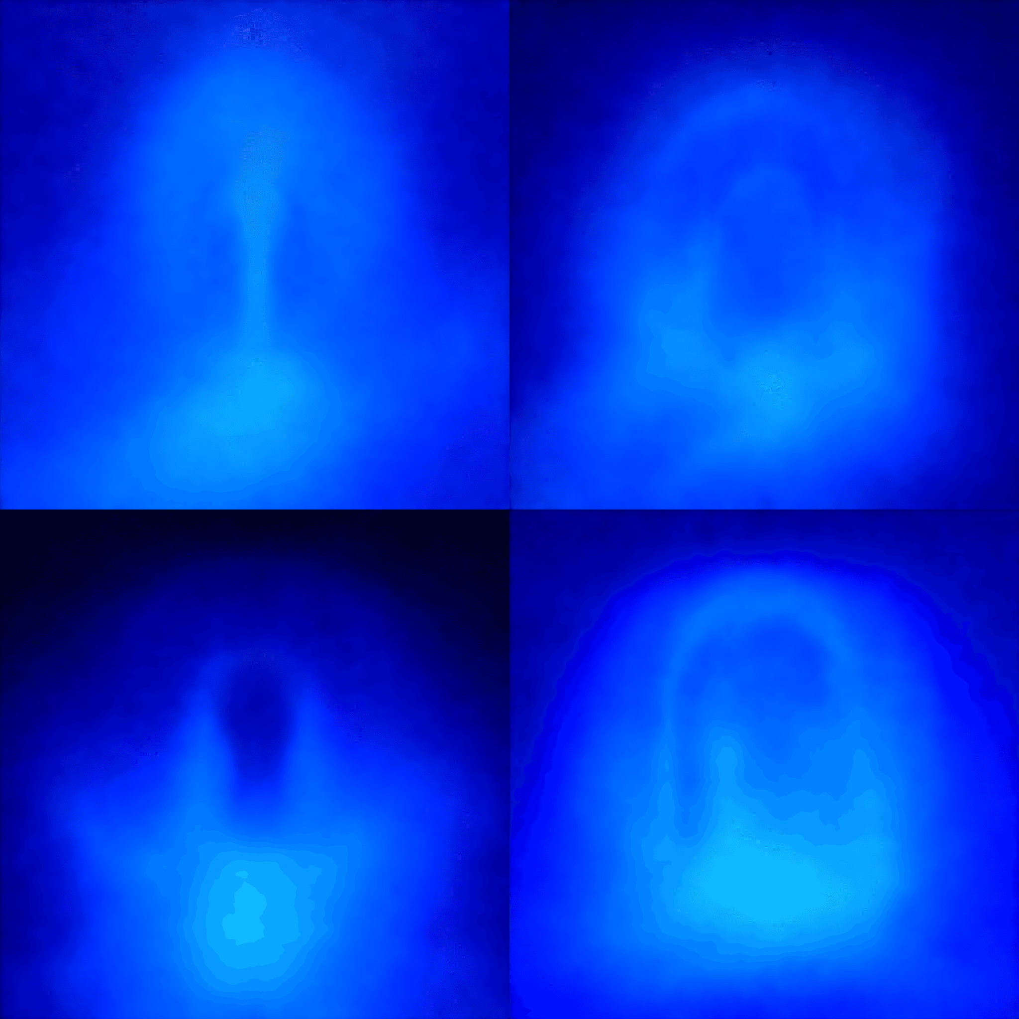 WPCasa WordPress Plugin CVE-2025-9321 Code Injection Vulnerability: Brief Summary and Technical Review